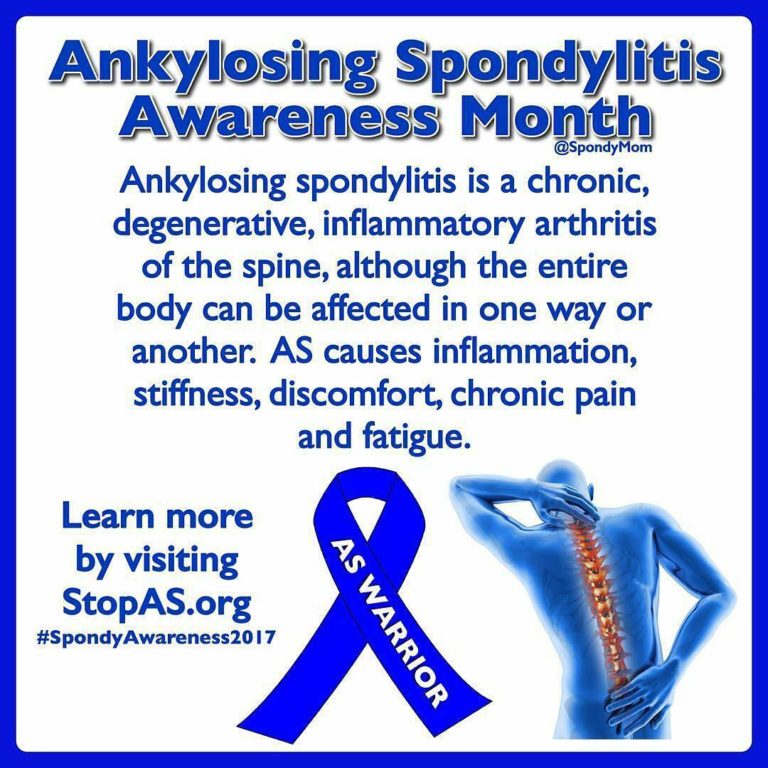 ankylosingspondylitis_ig Braydon Vo Physiotherapy